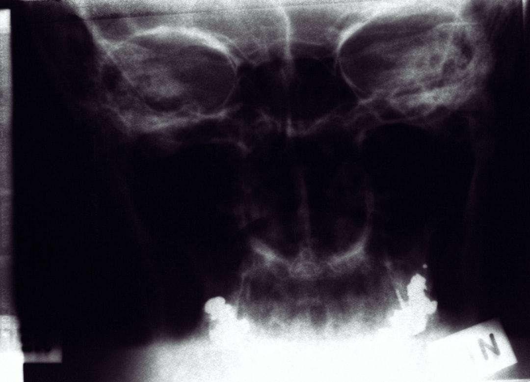 découvrez le syndrome de houdini : causes, symptômes et conséquences. comprenez ce trouble rare où les patients retirent ou déplacent eux-mêmes des dispositifs médicaux internes. informations, solutions et conseils d’experts.
