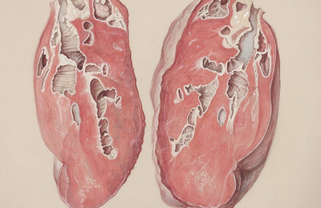 découvrez le syndrome de houdini : ses causes, ses symptômes et les traitements possibles. informez-vous sur ce phénomène rare touchant le système digestif.