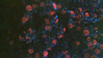 découvrez le fascinant phénomène des tétrachromates, ces personnes dotées d'une vision unique capables de percevoir un spectre de couleurs bien plus large que la moyenne. explorez les causes, les implications et la science derrière cette singularité visuelle rare.
