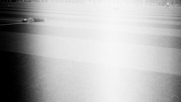 Découvrez le mystère du syndrome de la selle turcique vide